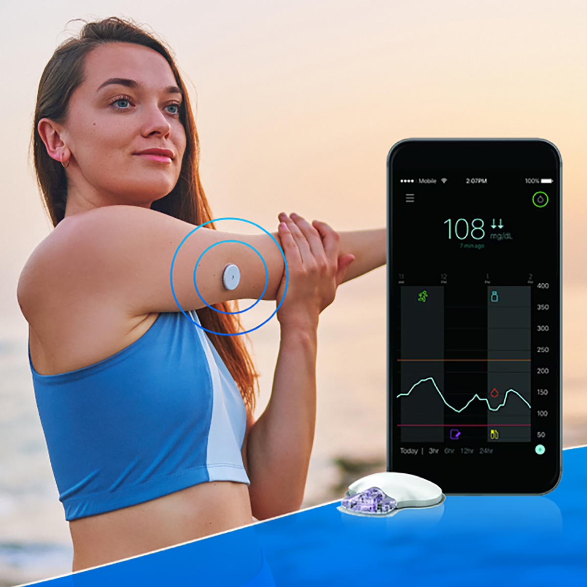 Gói theo dõi glucose liên tục 24 giờ (CGM) mà không cần kiểm tra ngón tay