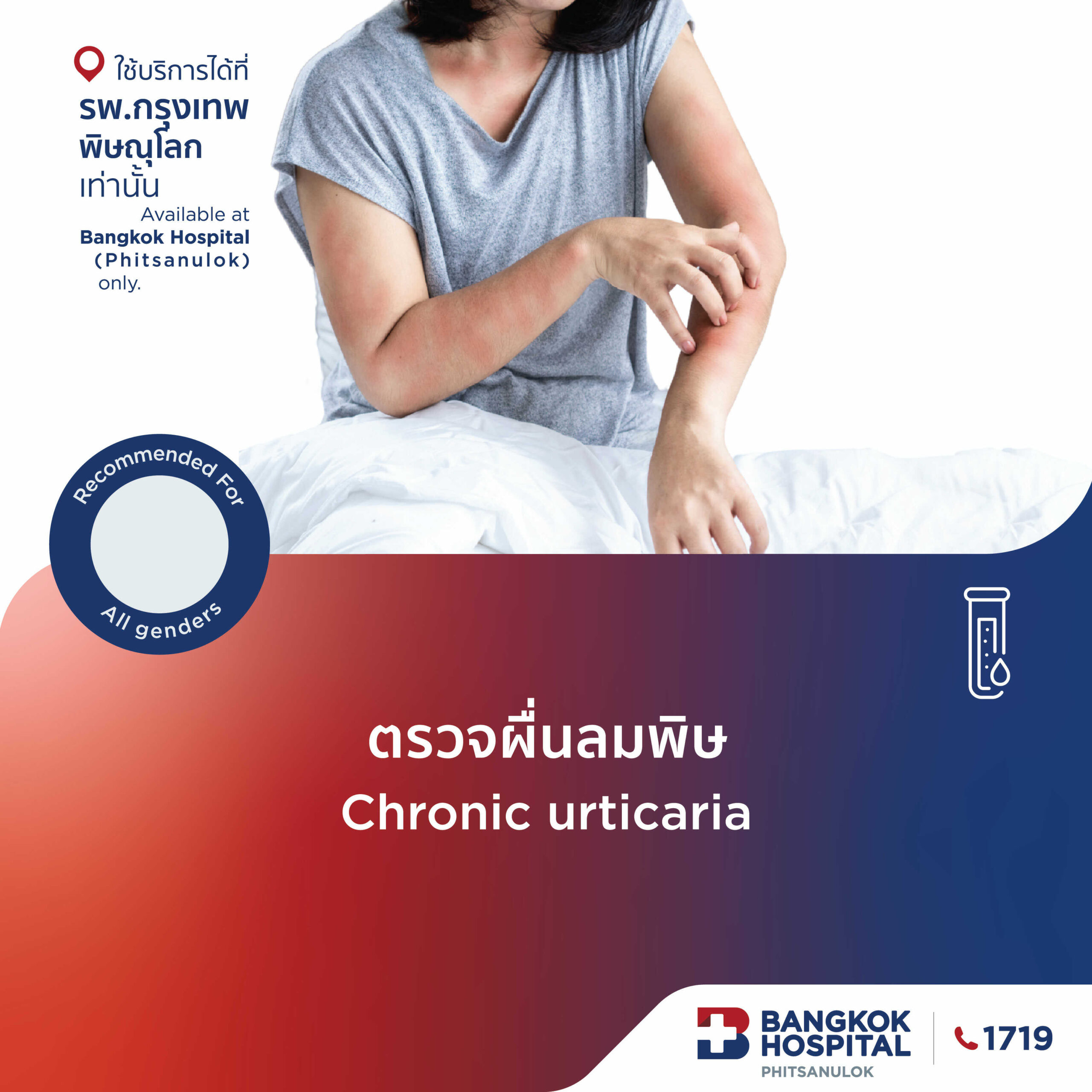 ตรวจหาผื่นลมพิษ