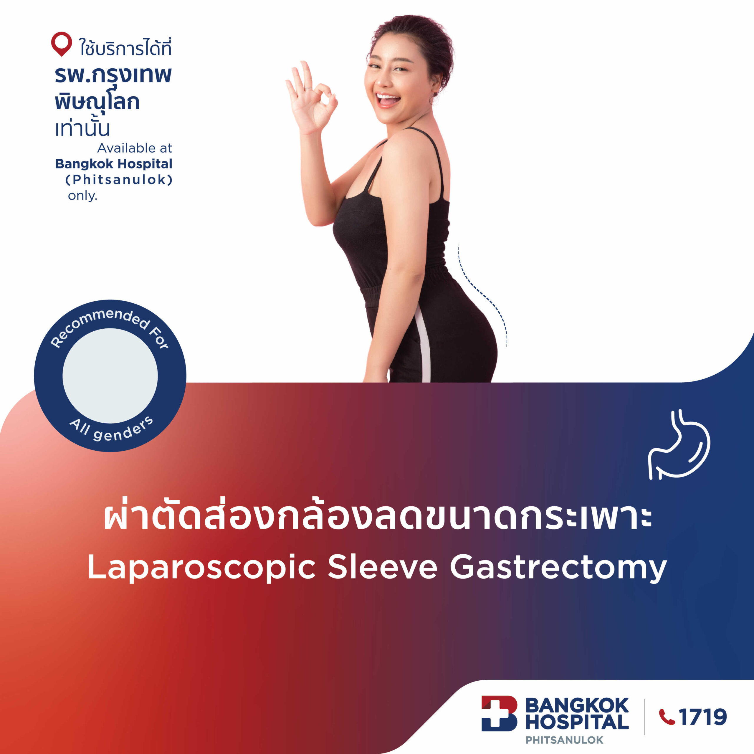 ผ่าตัดส่องกล้องลดขนาดกระเพาะ