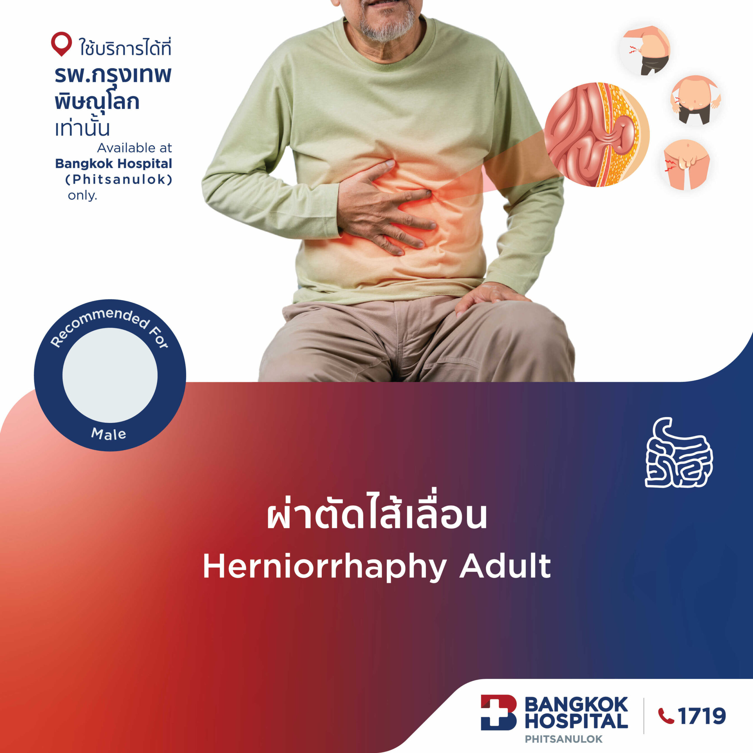 ผ่าตัดไส้เลื่อน