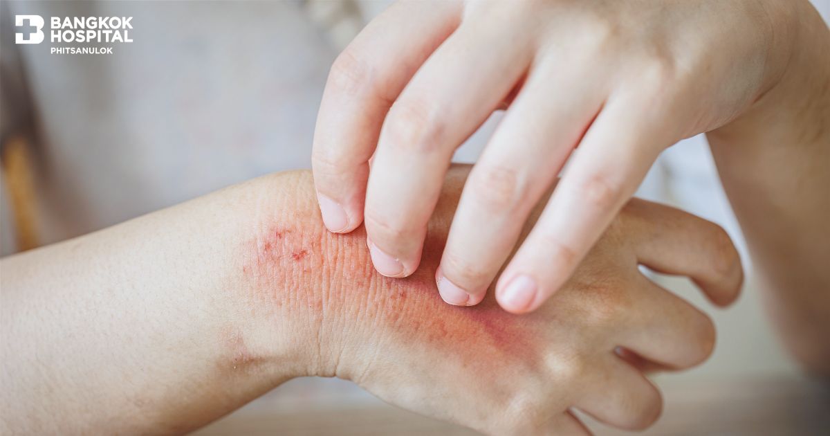 Fungal Infections: An Overlooked Silent Danger