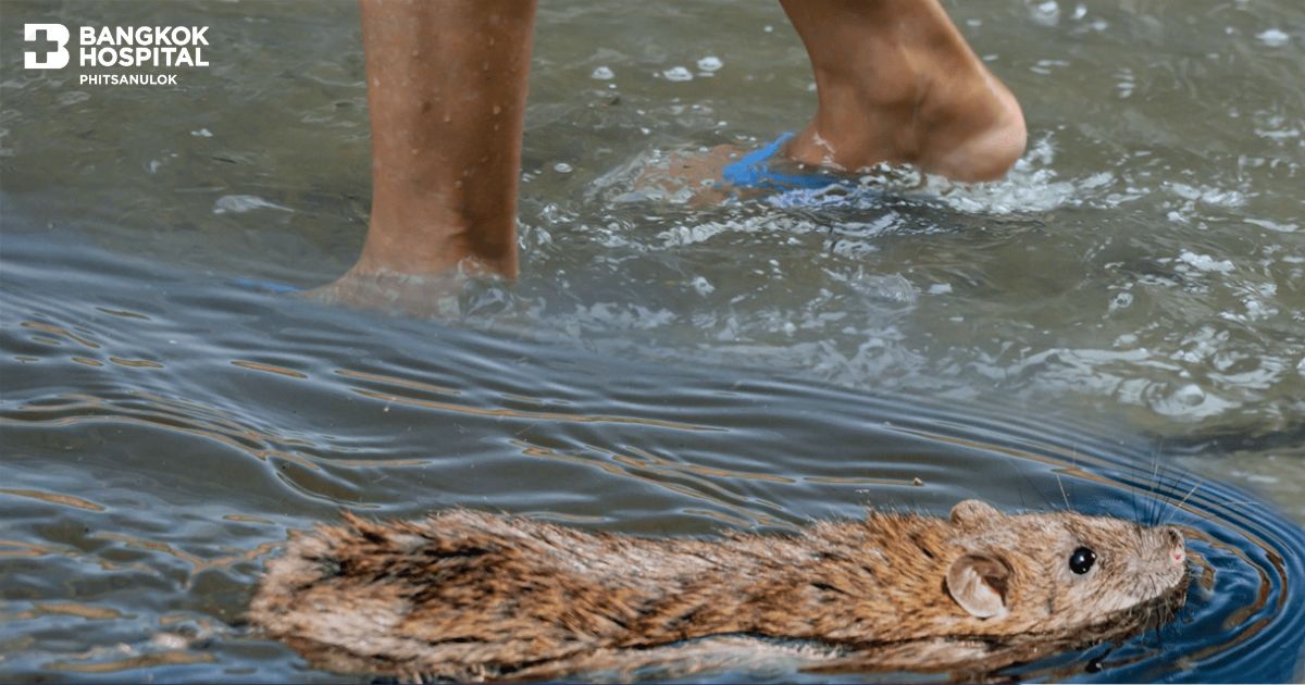 Leptospirosis: The Silent Threat Not to Be Overlooked During the Rainy Season