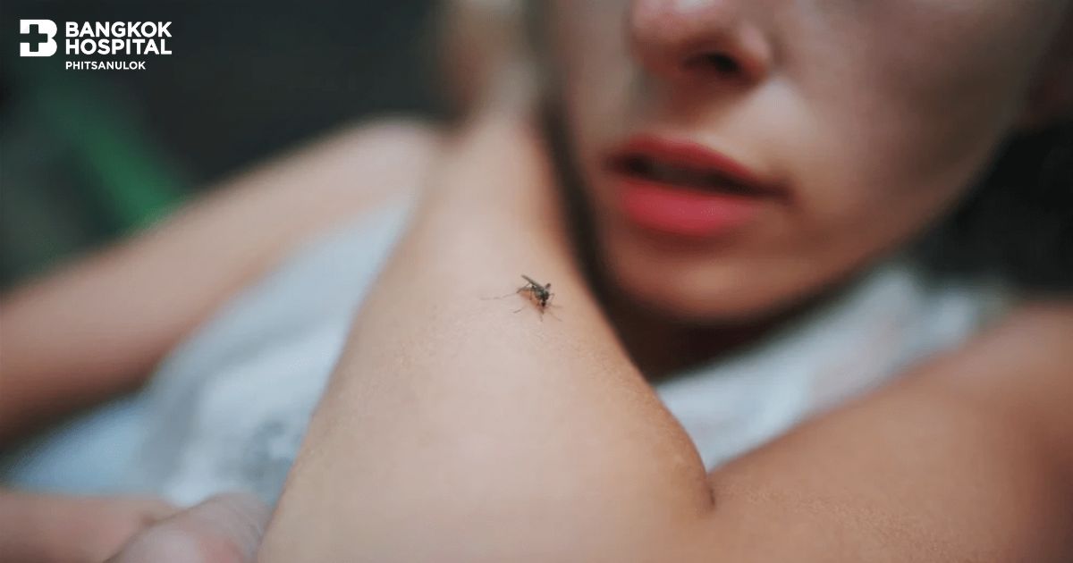 Dengue Fever: Understanding Prevention and Treatment