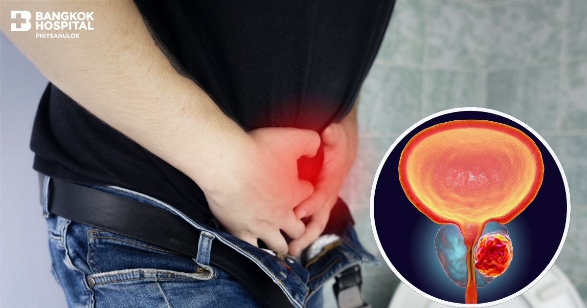 Treatment of Enlarged Prostate in Phitsanulok Province