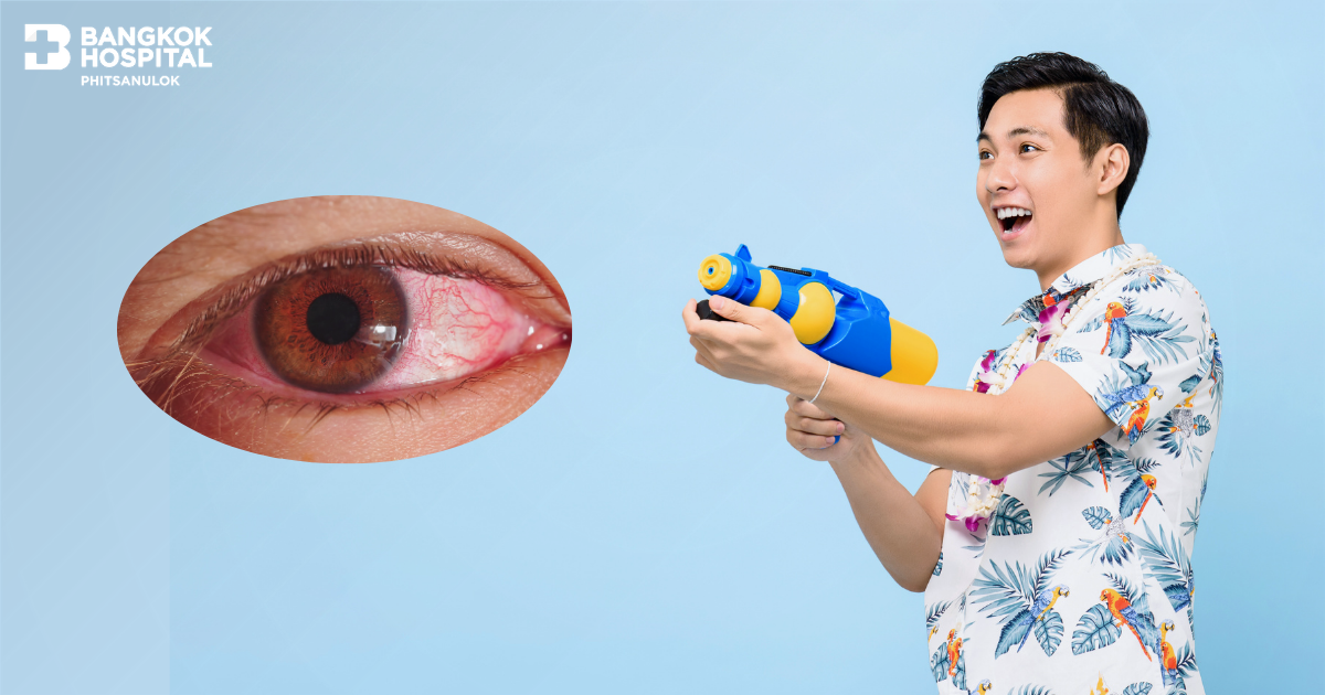 How to Enjoy Songkran Safely—Protecting Your Eyes