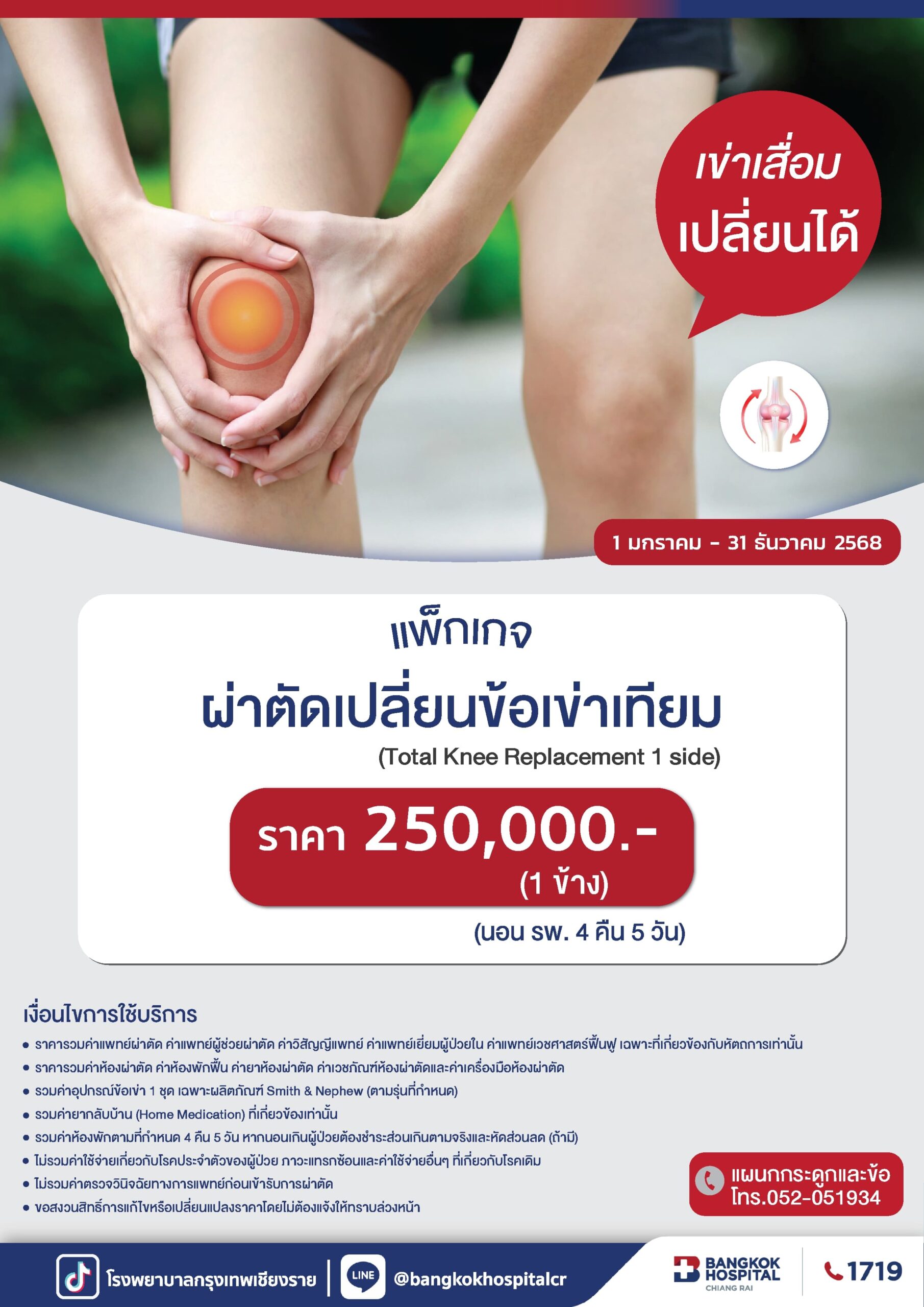 Total knee replacement 1 side 2025