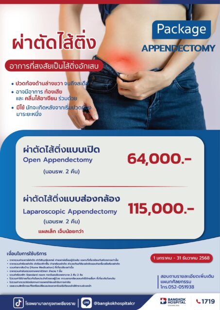 แพ็กเกจผ่าตัดไส้ติ่ง 2025