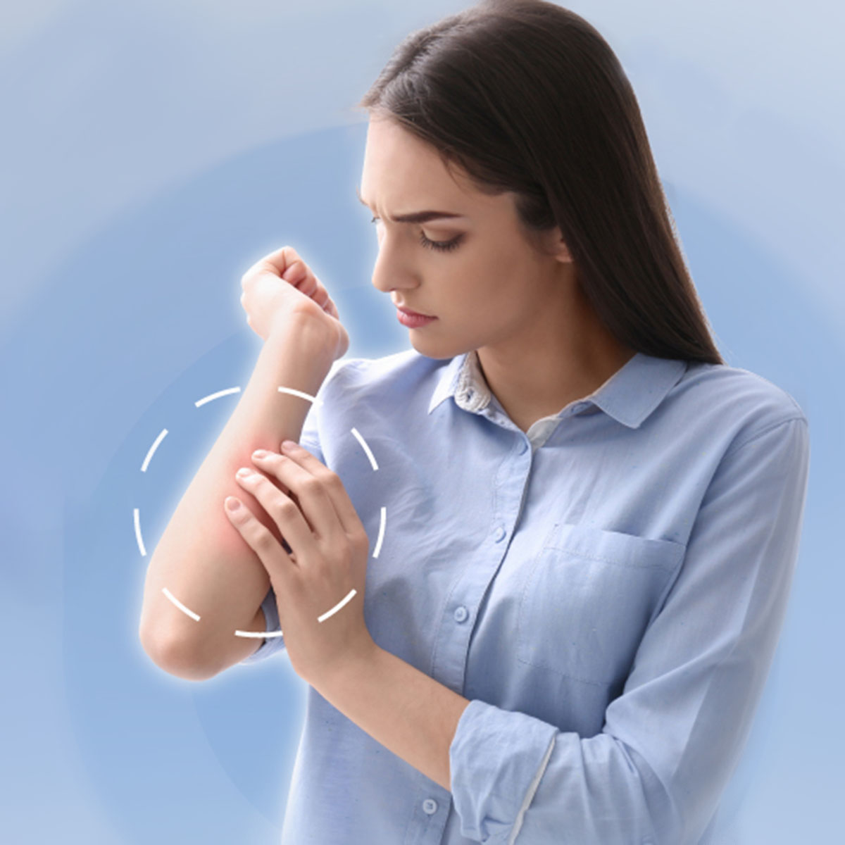 Gói Xét Nghiệm Kháng Thể IgE Cụ Thể Cho Thực Phẩm