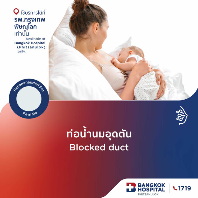 รักษาท่อน้ำนมอุดตัน
