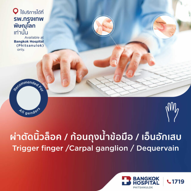 ผ่าตัดนิ้วล็อค ก้อนถุงน้ำข้อมือ เอ็นอักเสบ