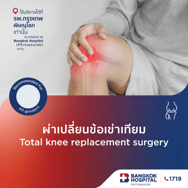 ผ่าตัดเปลี่ยนข้อเข่าเทียม