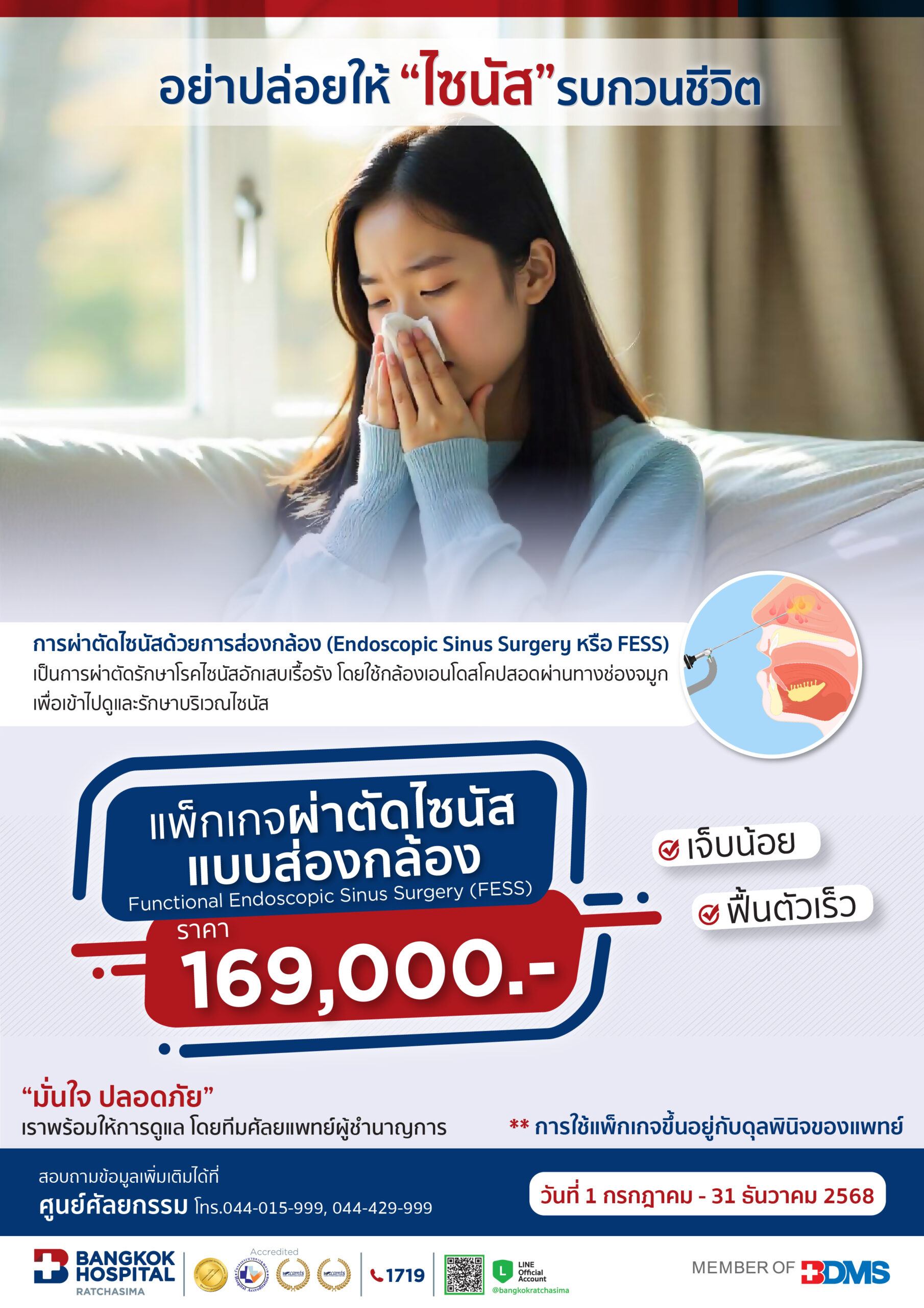 การผ่าตัดไซนัสด้วยการส่องกล้อง