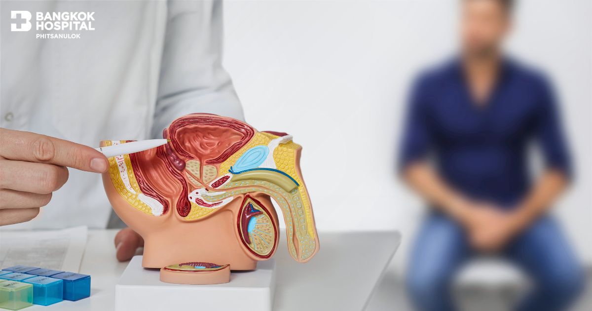 Benign Prostatic Hyperplasia (BPH): A Common Yet Overlooked Condition Among Men