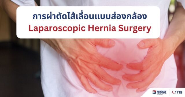 การผ่าตัดไส้เลื่อนแบบส่องกล้อง Image