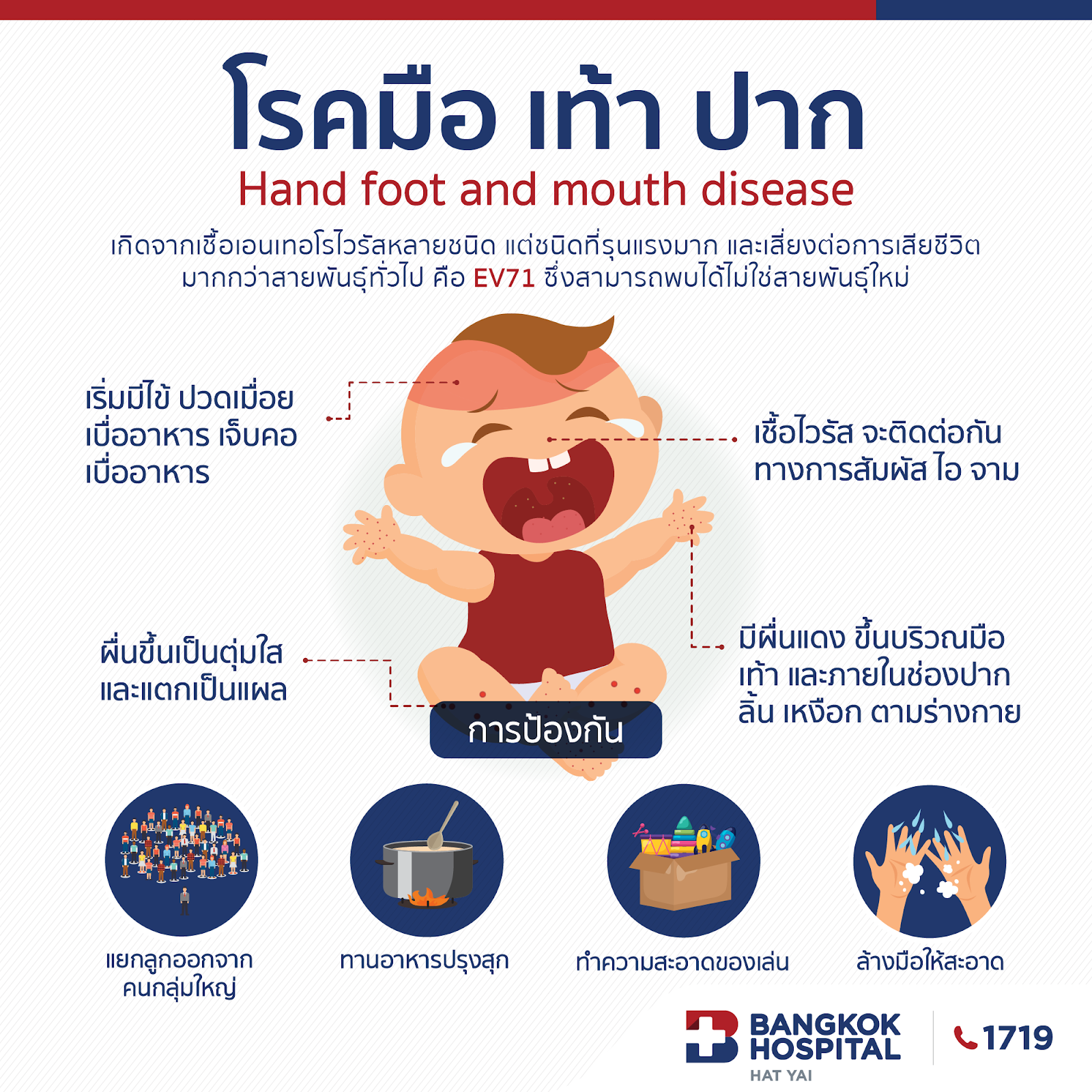 โรคมือ เท้า ปาก...ในช่วงฤดูฝน อากาศชื้นและเย็น