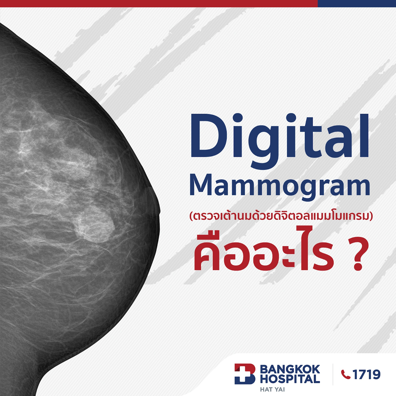 ดิจิตอลแมมโมแกรม (Digital Mammogram) คืออะไร?