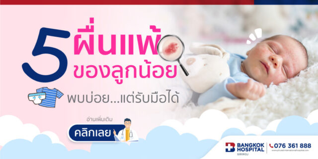5 ผื่นแพ้ของลูกน้อย พบบ่อย...แต่รับมือได้ Image