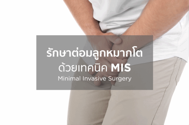รักษาต่อมลูกหมากโต ด้วยเทคนิก MIS Image