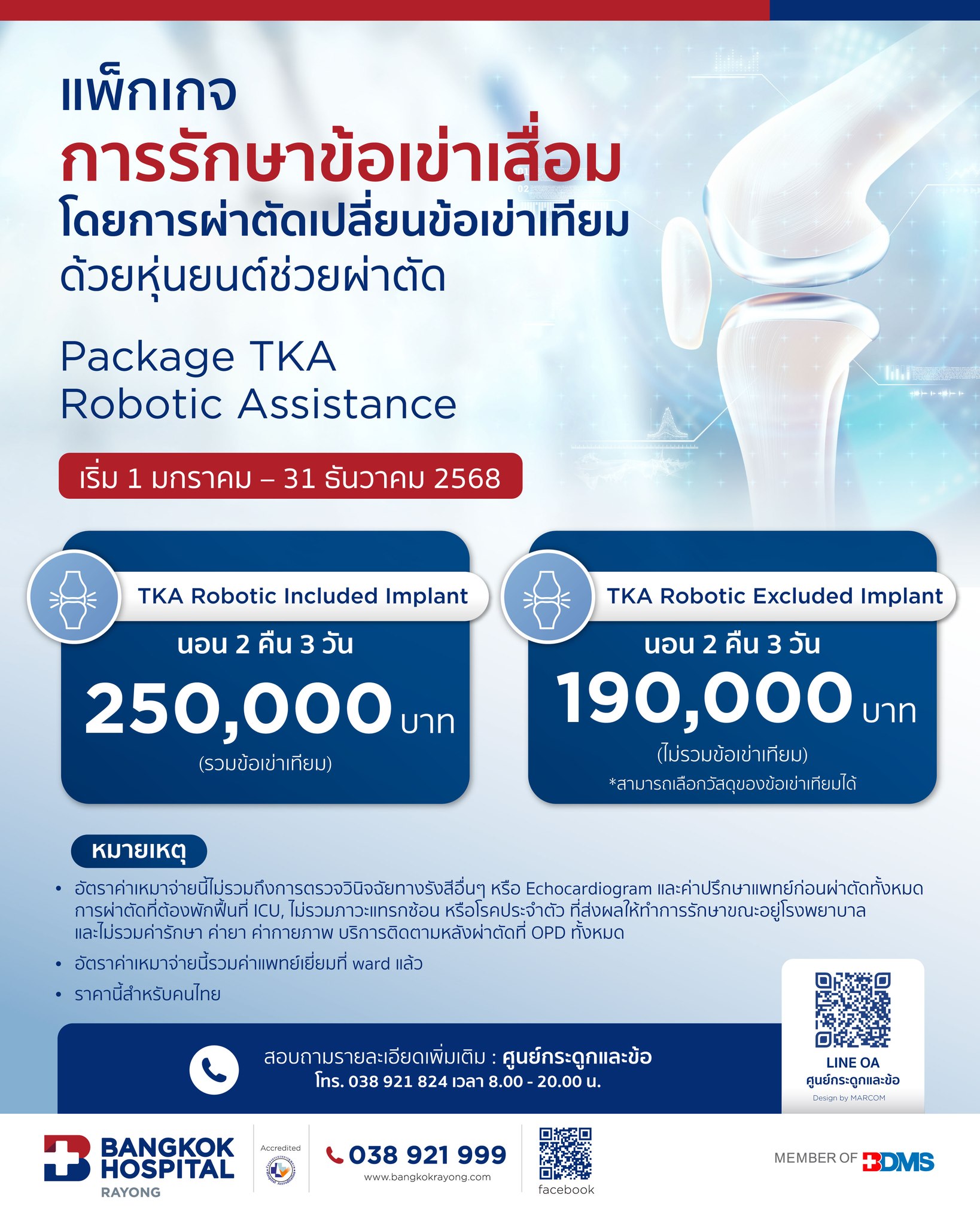 ผ่าตัดเข่า ด้วยหุ่นยนต์ โรงพยาบากรุงเทพระยอง