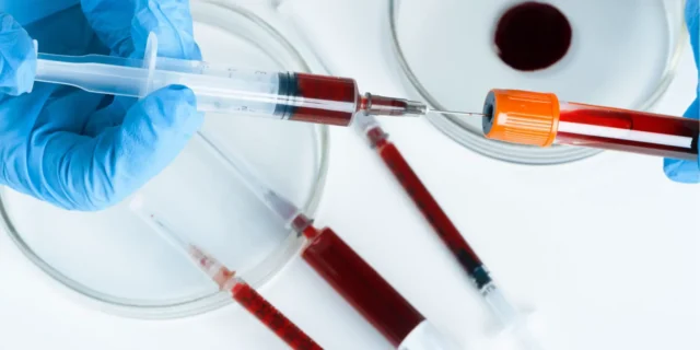 Liquid Biopsy Image