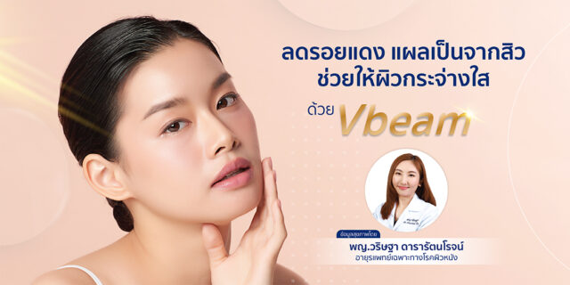 ลดรอยแดง แผลเป็นจากสิว ช่วยให้ผิวกระจ่างใสด้วย วีบีม (Vbeam)