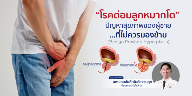 โรคต่อมลูกหมากโต…ปัญหาสุขภาพของผู้ชายที่ไม่ควรมองข้าม (Benign Prostate Hyperplasia) Image