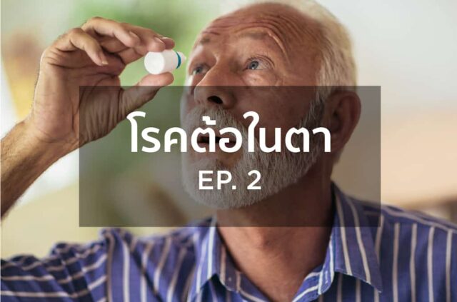 โรคต้อในตา EP2