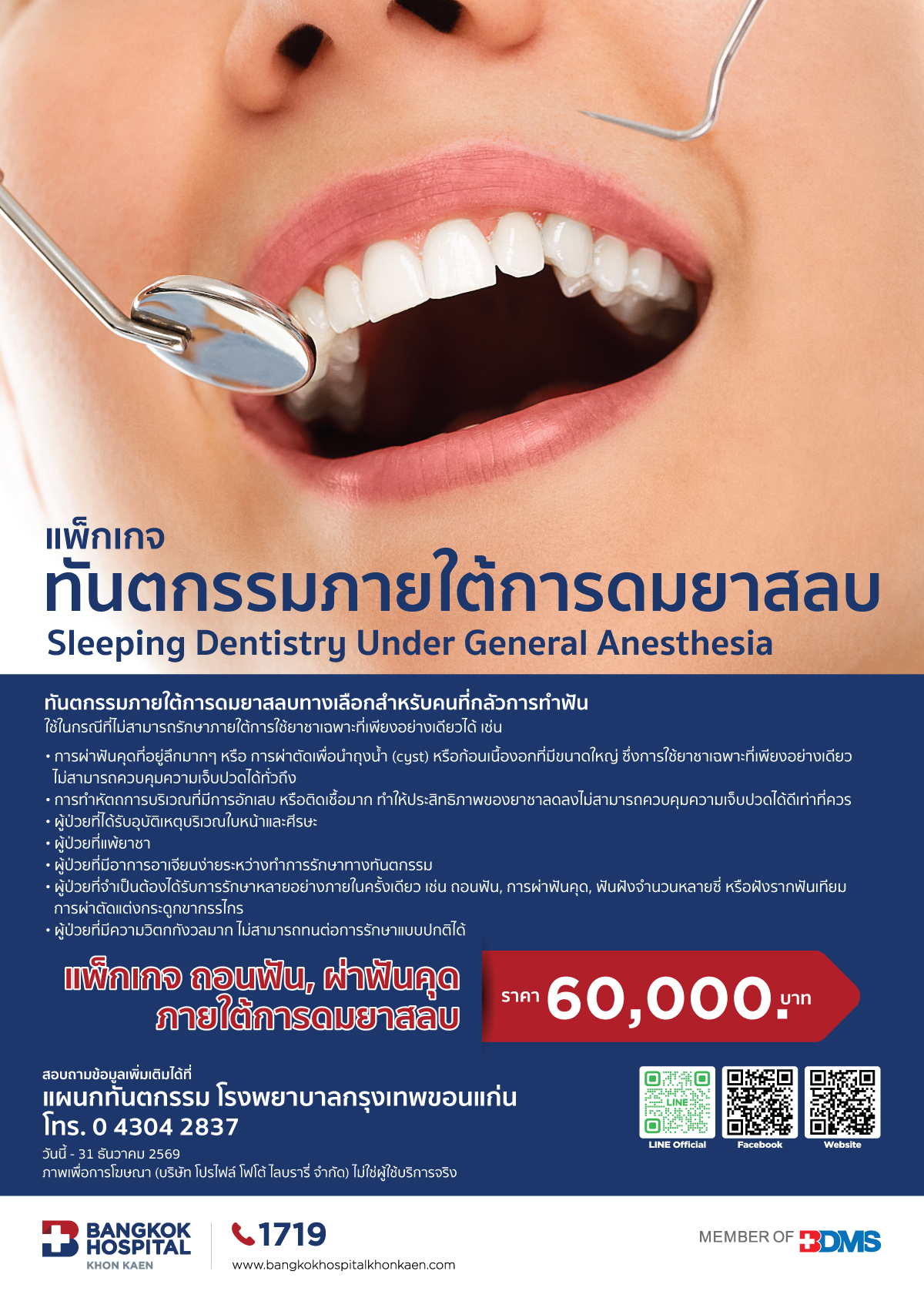 ทันตกรรมภายใต้การดมยาสลบ (ถอนฟัน, ผ่าฟันคุด)