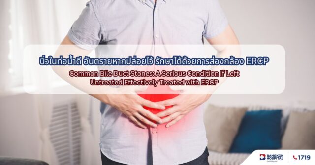 นิ่วในท่อน้ำดี อันตรายหากปล่อยไว้ รักษาได้ด้วยการส่องกล้อง ERCP Image
