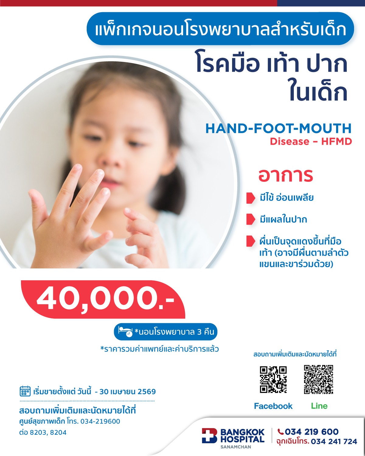 โรคมือ เท้า ปาก (Hand, Foot, and Mouth Disease)