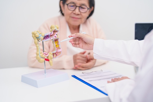 แบบประเมินความเสี่ยงมะเร็งลำไส้ใหญ่และทวารหนัก (Colorectal Cancer Risk Screening Score)