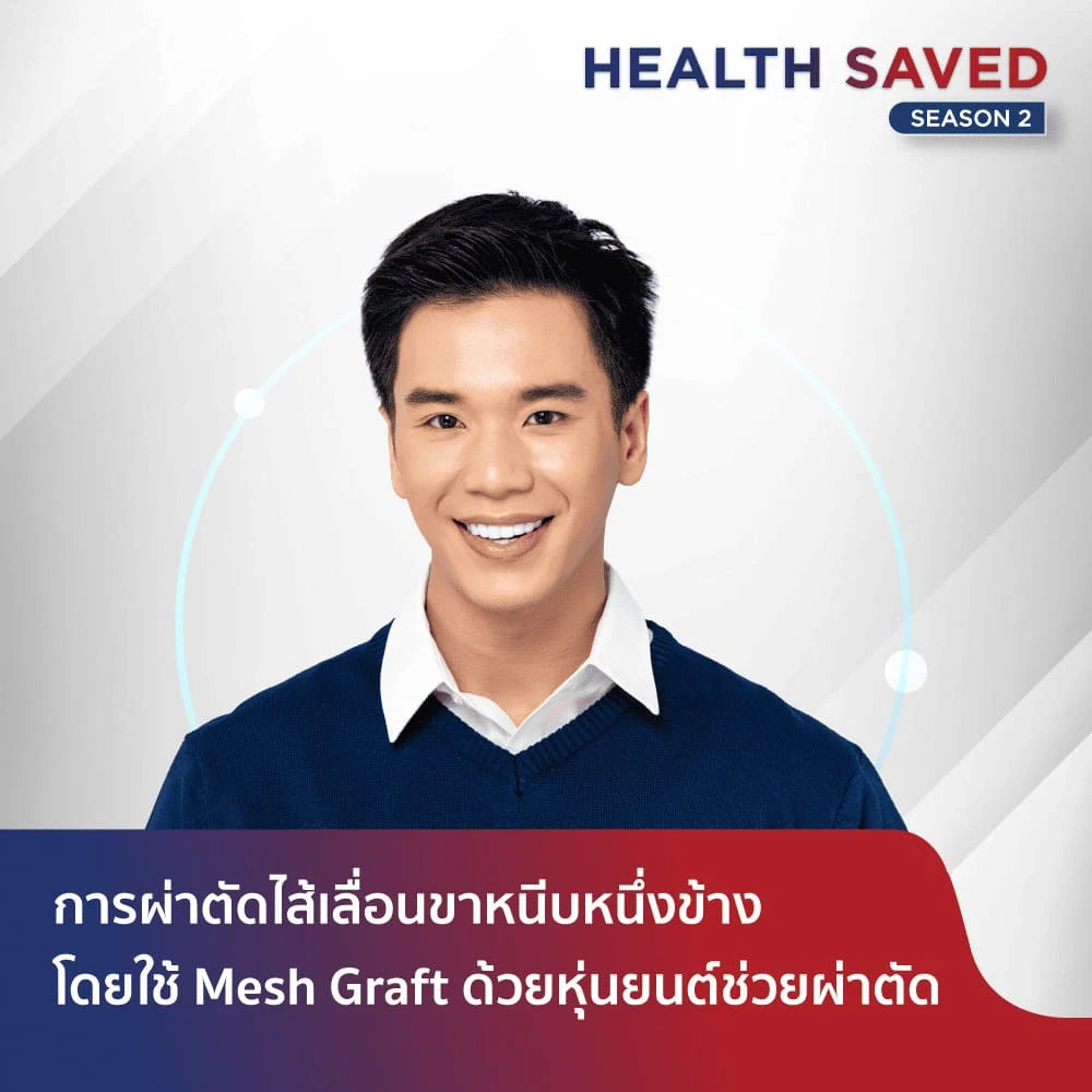 การผ่าตัดไส้เลื่อนขาหนีบหนึ่งข้างโดยใช้ Mesh Graft (แผ่นวัสดุเสริมความแข็งแรง) ด้วยหุ่นยนต์ช่วยผ่าตัด