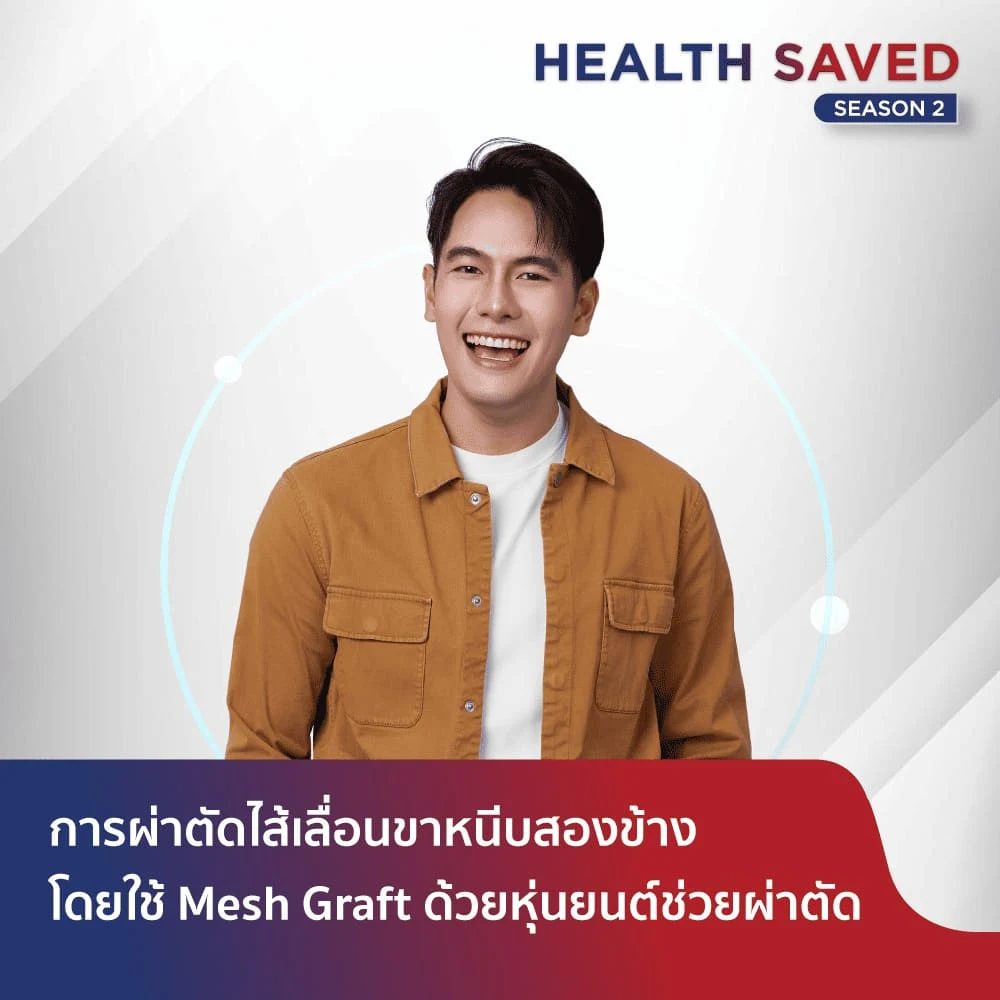 การผ่าตัดไส้เลื่อนขาหนีบสองข้างโดยใช้ Mesh Graft (แผ่นวัสดุเสริมความแข็งแรง) ด้วยหุ่นยนต์ช่วยผ่าตัด