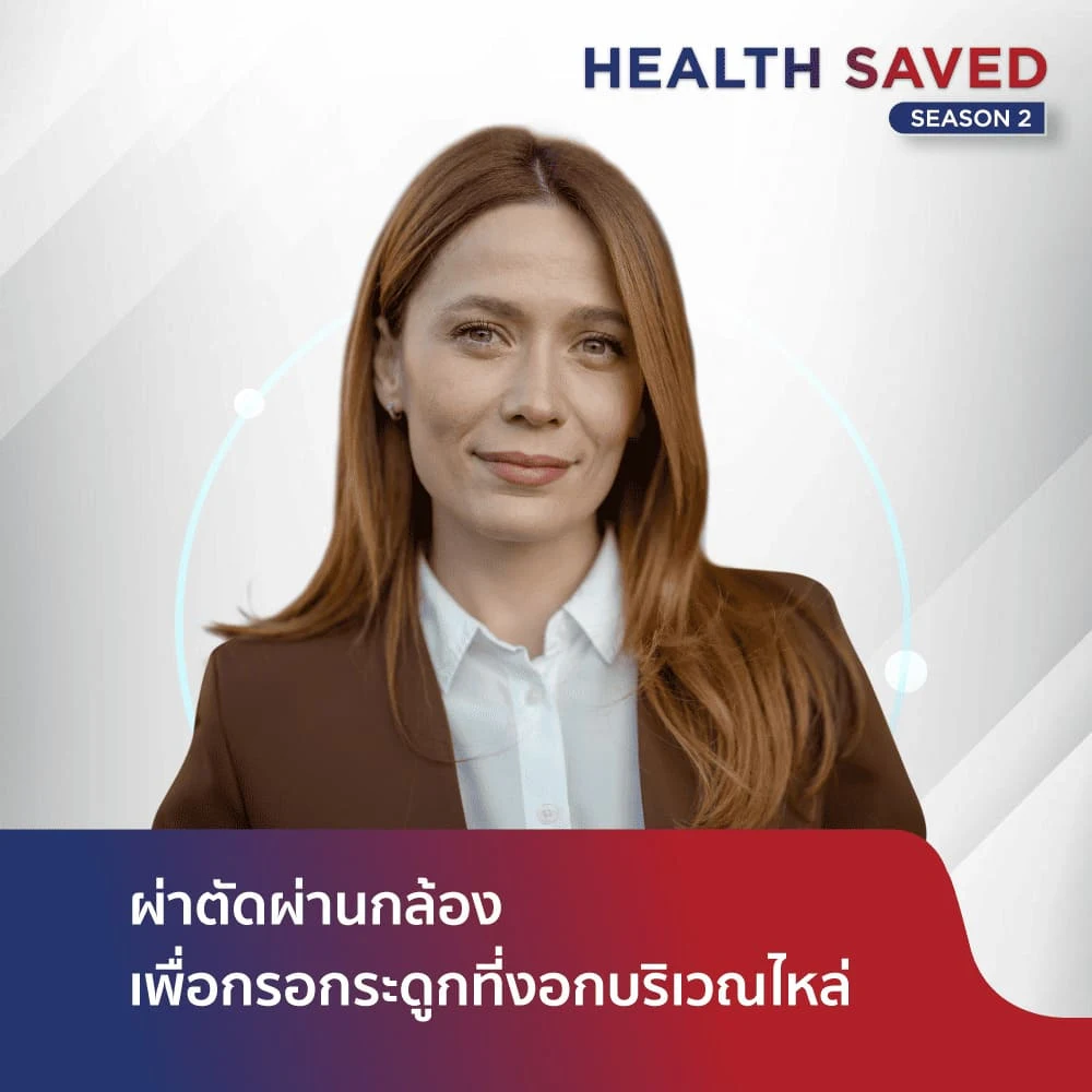 การผ่าตัดผ่านกล้องเพื่อกรอกระดูกที่งอกบริเวณไหล่
