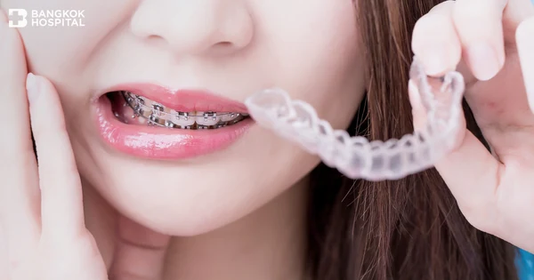Метод Invisalign Debonding позволяет отказаться от традиционных брекетов, не начиная лечение заново.