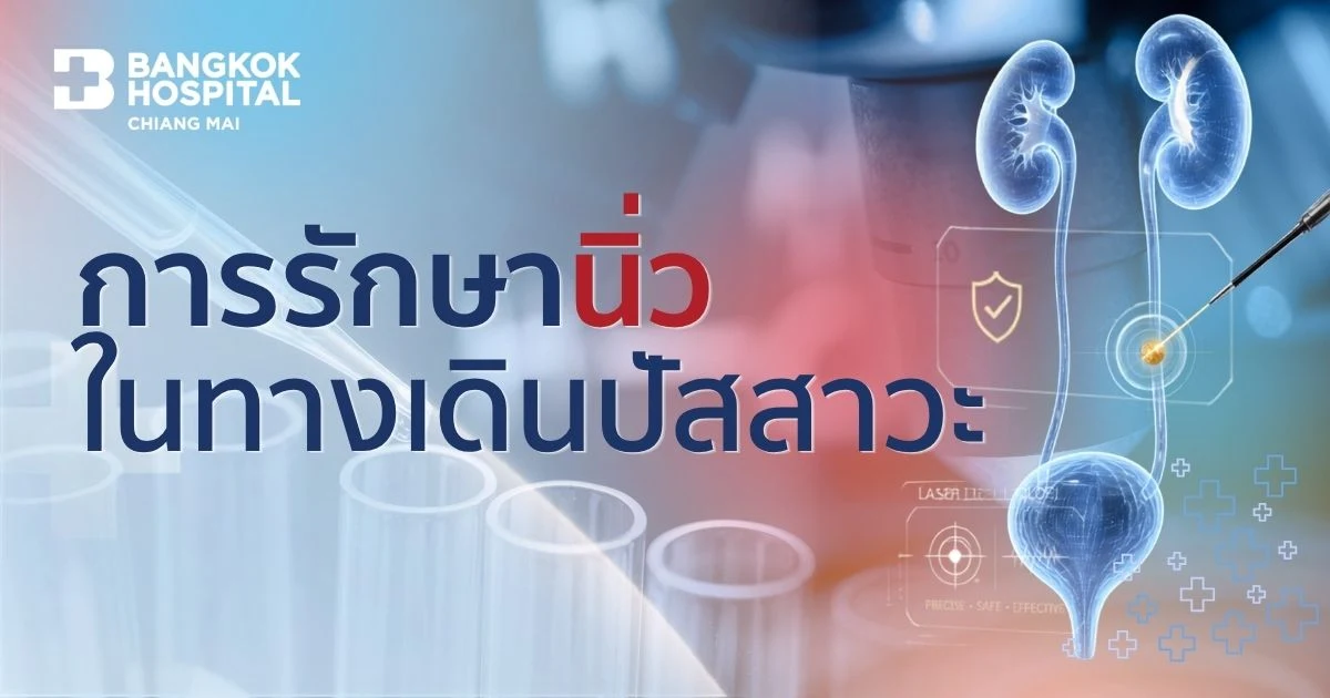 Urinary Tract Stones: Is Surgery Necessary? Get to Know the Treatment Methods Suitable for Each Person