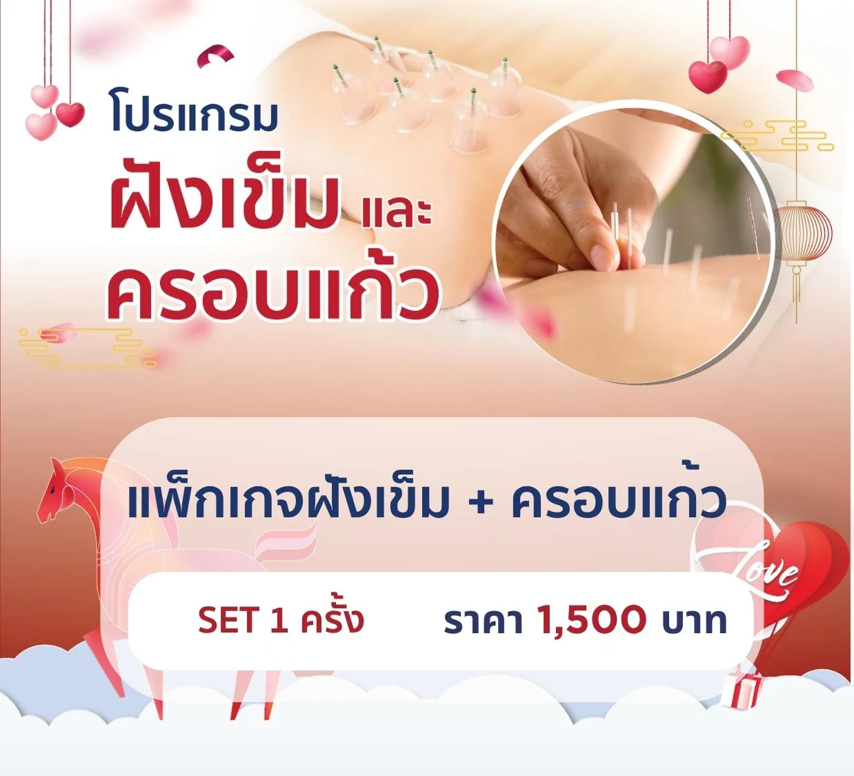 แพ็กเกจฝังเข็ม+ครอบแก้ว 1 ครั้ง
