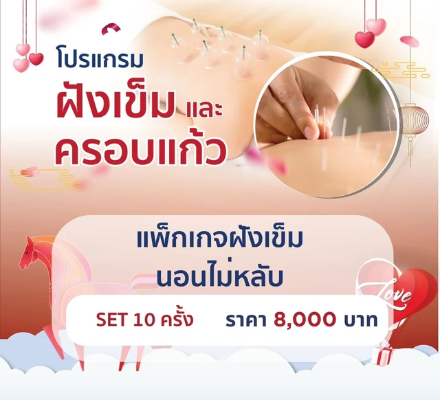 แพ็กเกจฝังเข็มนอนไม่หลับ 10 ครั้ง