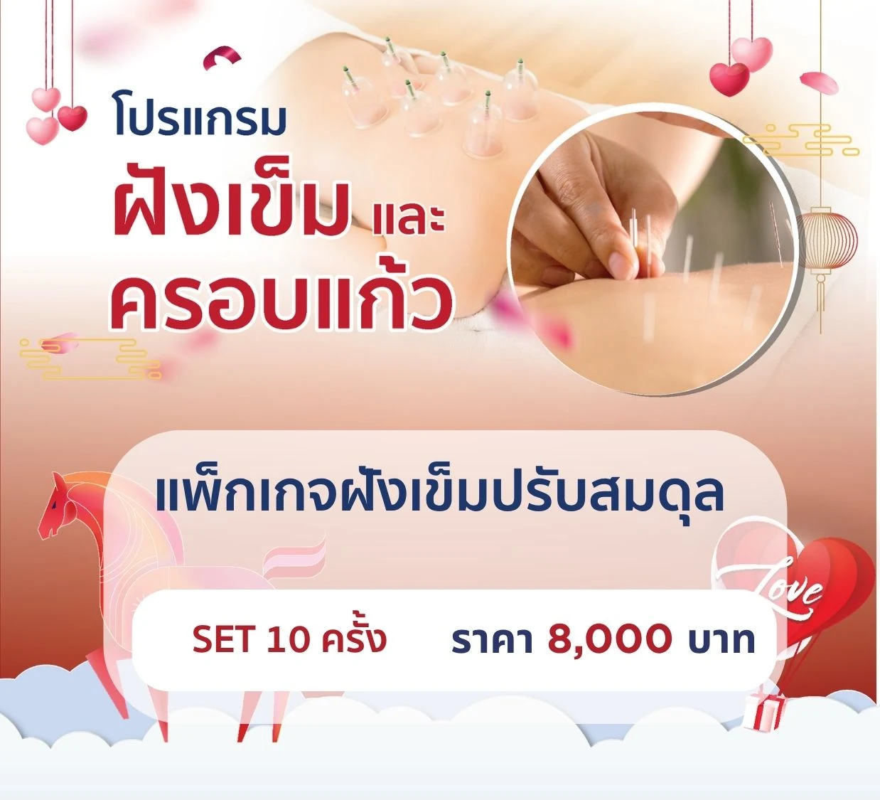 แพ็กเกจฝังเข็มปรับสมดุล 10 ครั้ง