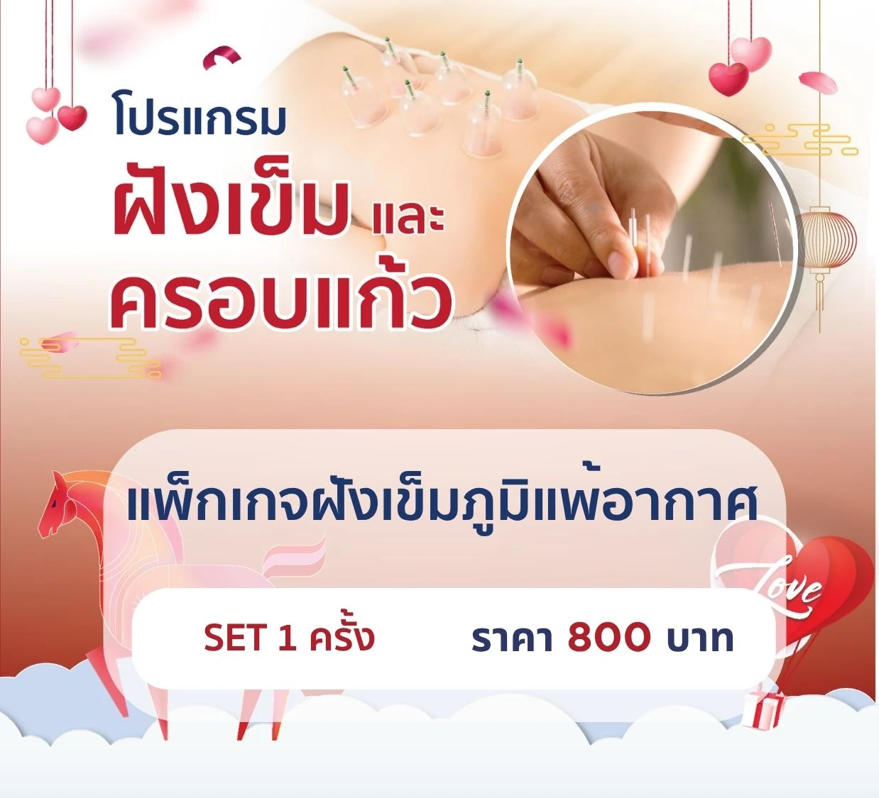 แพ็กเกจฝังเข็มภูมิแพ้อากาศ 1 ครั้ง