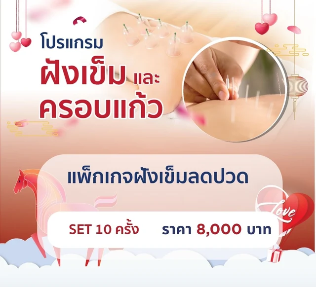 แพ็กเกจฝังเข็มลดปวด 10 ครั้ง