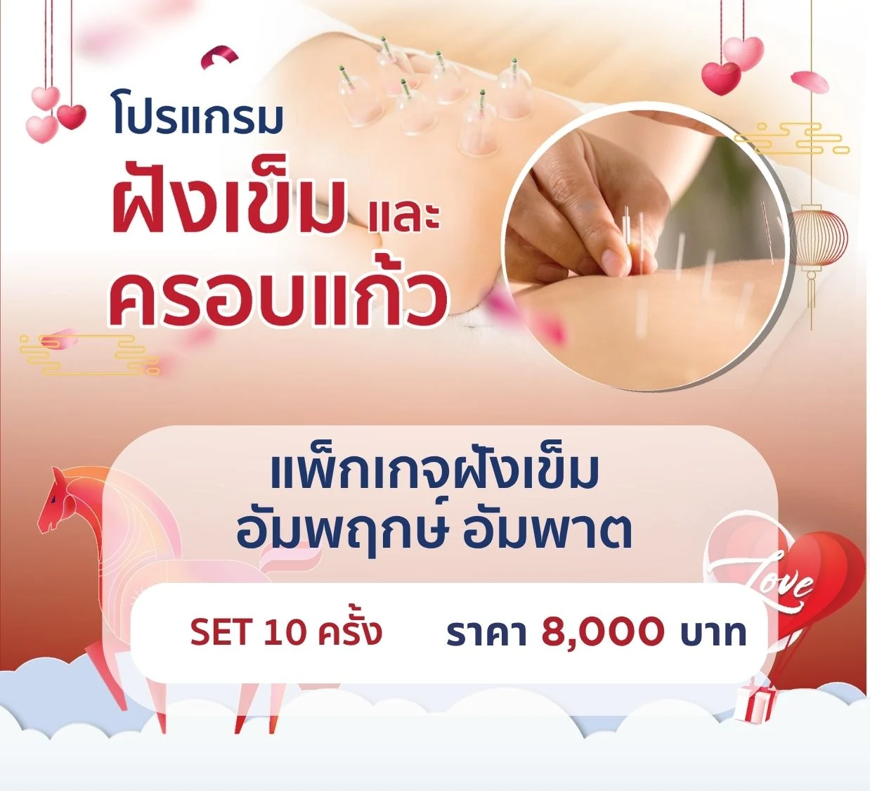 แพ็กเกจฝังเข็มอัมพฤกษ์ อัมพาต 10 ครั้ง