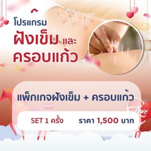 แพ็กเกจฝังเข็ม+ครอบแก้ว 1 ครั้ง