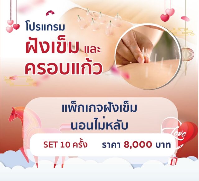 แพ็กเกจฝังเข็มนอนไม่หลับ 10 ครั้ง